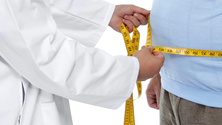 Obesity